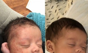 Tubby Todd All Over Salbe Bewertung 