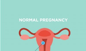 Was Sie über eine Eileiterschwangerschaft wissen müssen