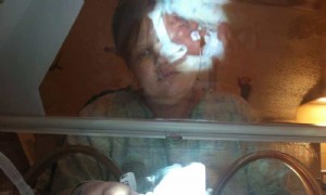 Was Sie wissen sollten, wenn Sie ein Frühgeborenes haben 