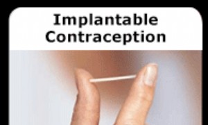 Implantierbare Empfängnisverhütung 