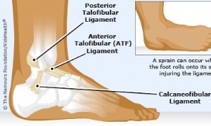 Knöchelverstauchungen 