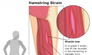 Oberschenkelverletzung 