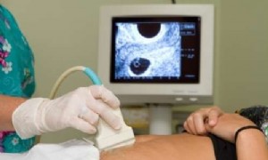 Was ist eine Eileiterschwangerschaft? 