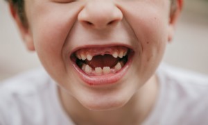 Milchzähne verlieren:Wann fallen sie aus und in welcher Reihenfolge? 
