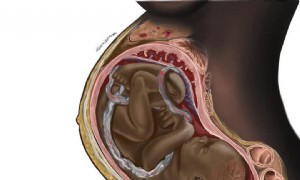 Schwarze medizinische Illustration der Schwangerschaft befeuert virale Diskussionen über Gerechtigkeit im Gesundheitswesen 