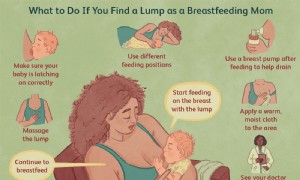 Wenn Sie beim Stillen einen Knoten in der Brust finden 