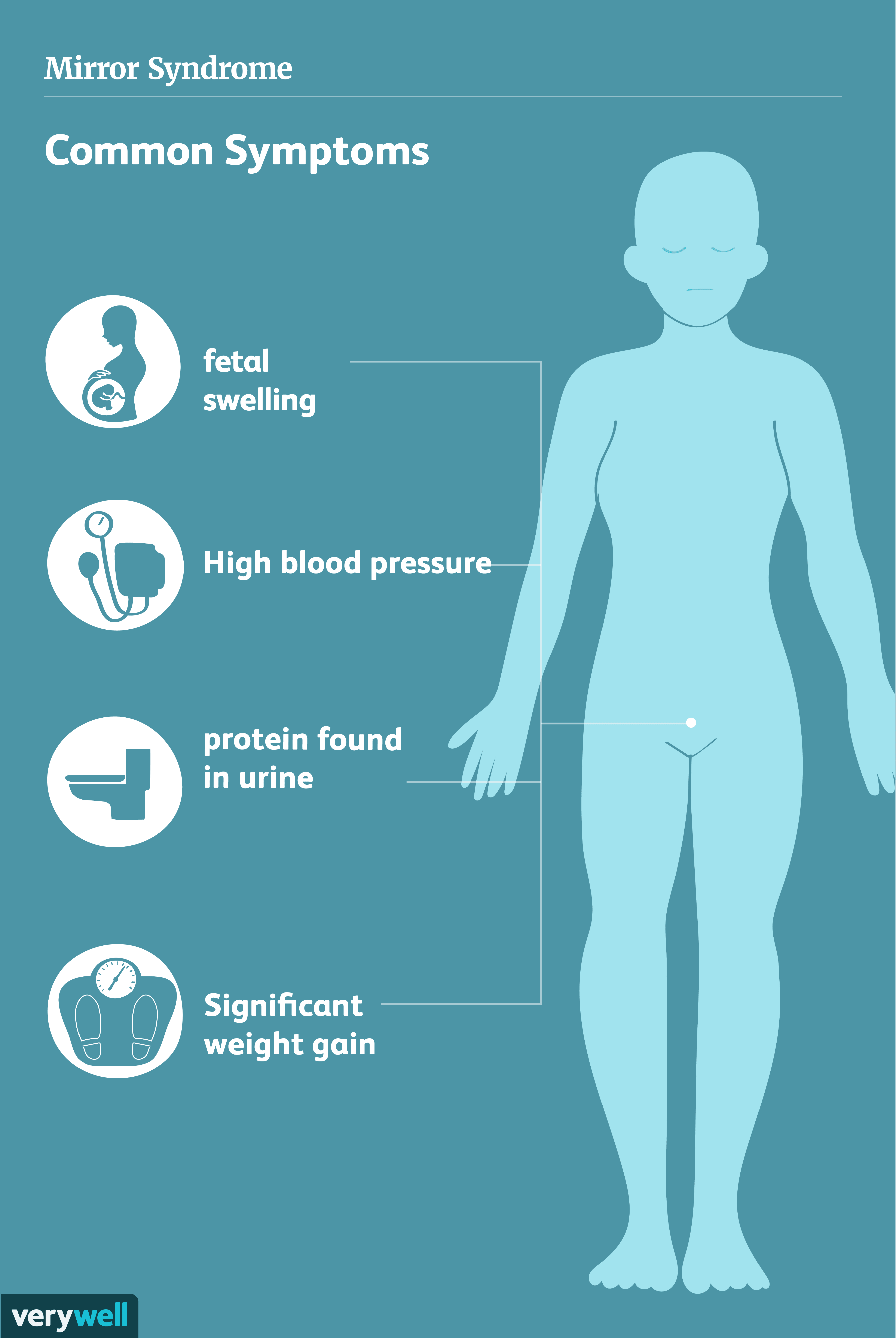 Ein Überblick über das Spiegelsyndrom 