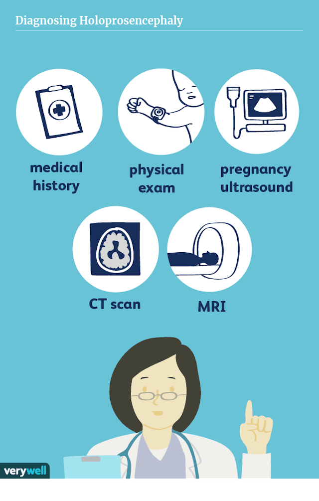 Was ist Holoprosenzephalie? 