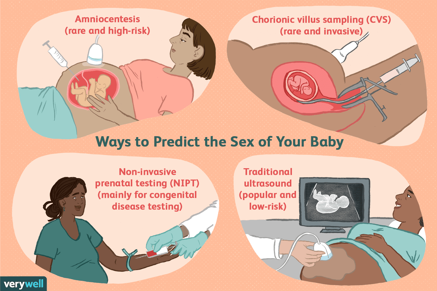 Fakten über die Vorhersage des Geschlechts Ihres Babys 